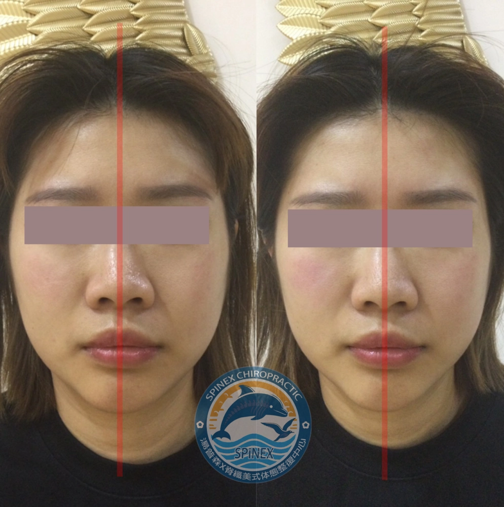 臉部均衡調理