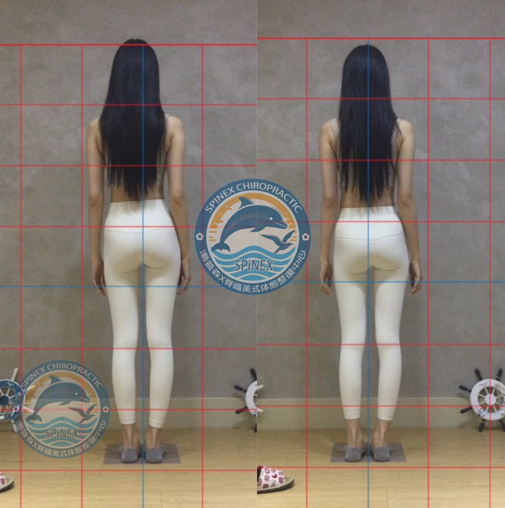 美式體態整復