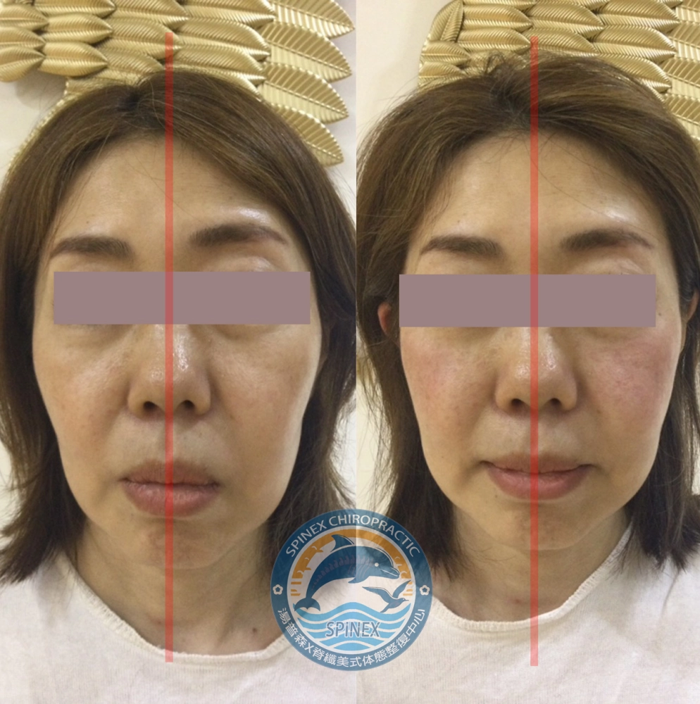 臉部均衡調理