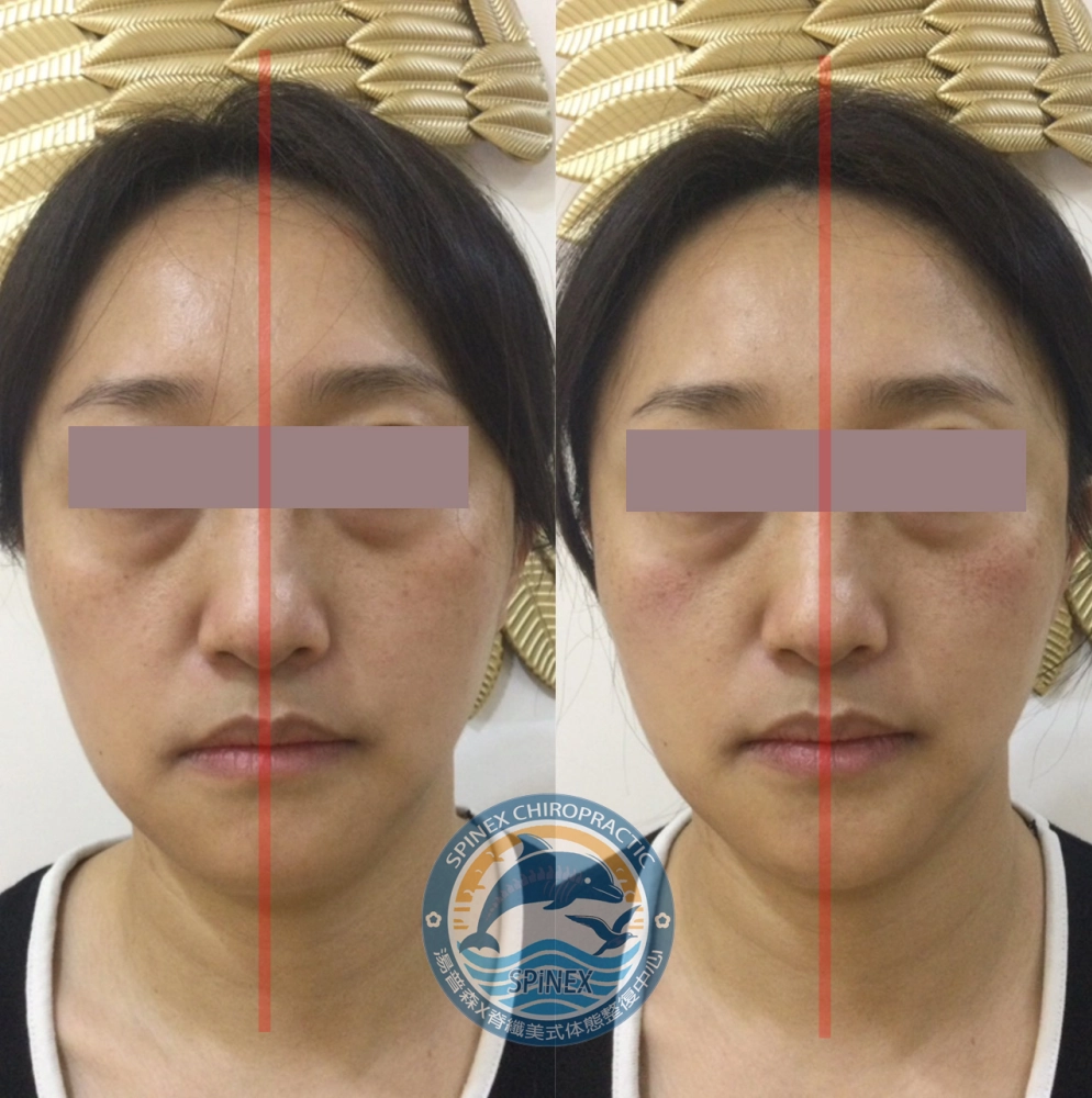 臉部均衡調理