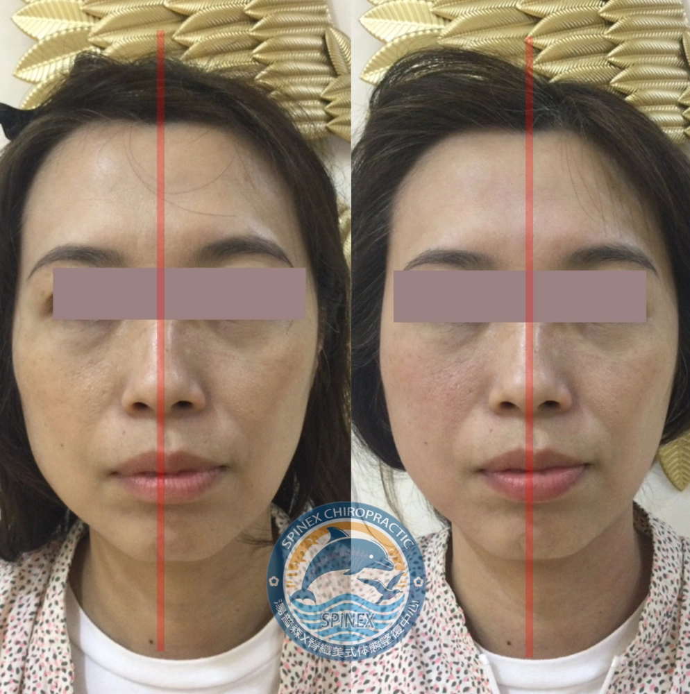 臉部均衡調理