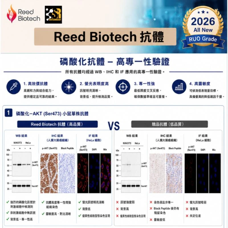 【Reed Biotech】磷酸化抗體新：高效價、高專一性驗證 新品上線！