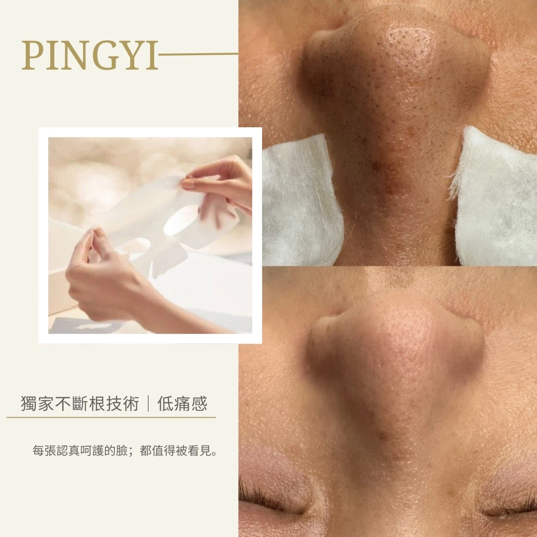｜粉刺手藝｜毛孔極淨｜