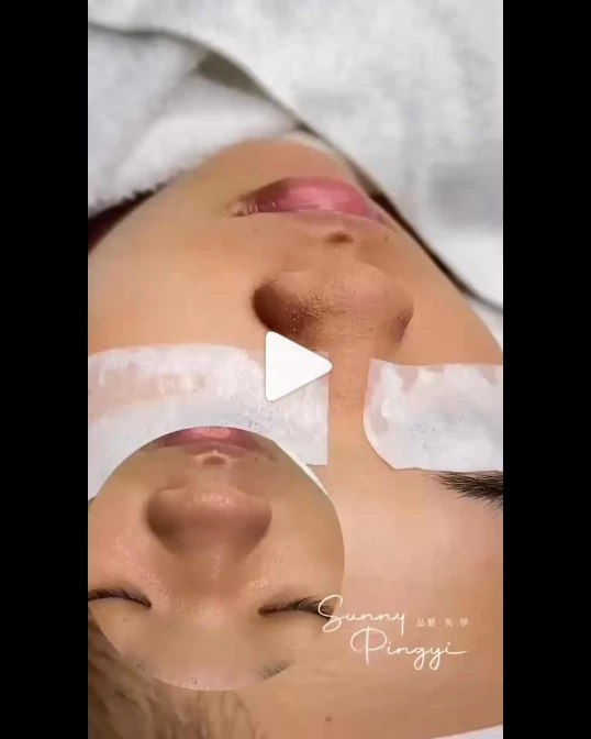 『之前因為膚況不好面試都沒有錄取⋯還好我有堅持來找妳，這次面試直接通過了！』