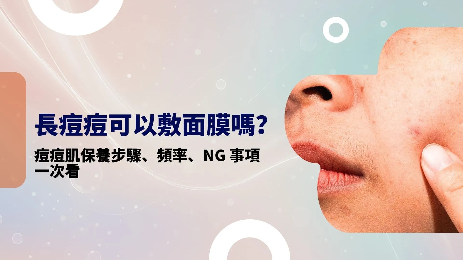 長痘痘可以敷面膜嗎？痘痘肌保養步驟、頻率、NG 事項一次看