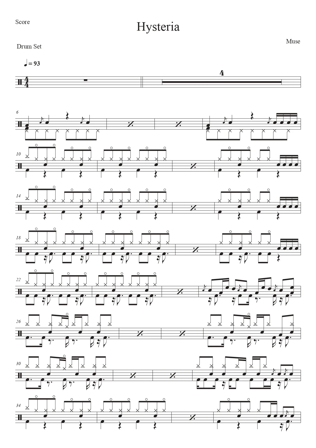 Hysteria