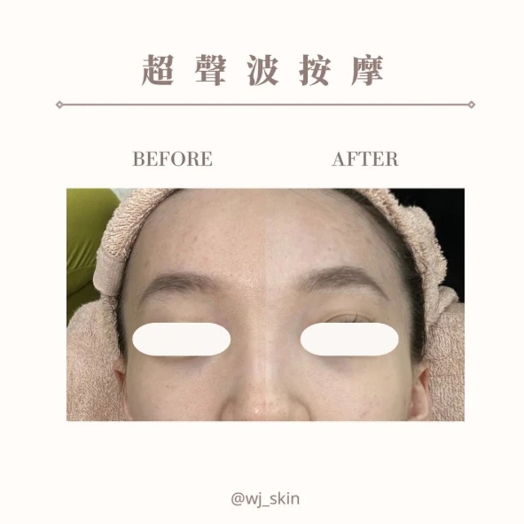 超聲波按摩
