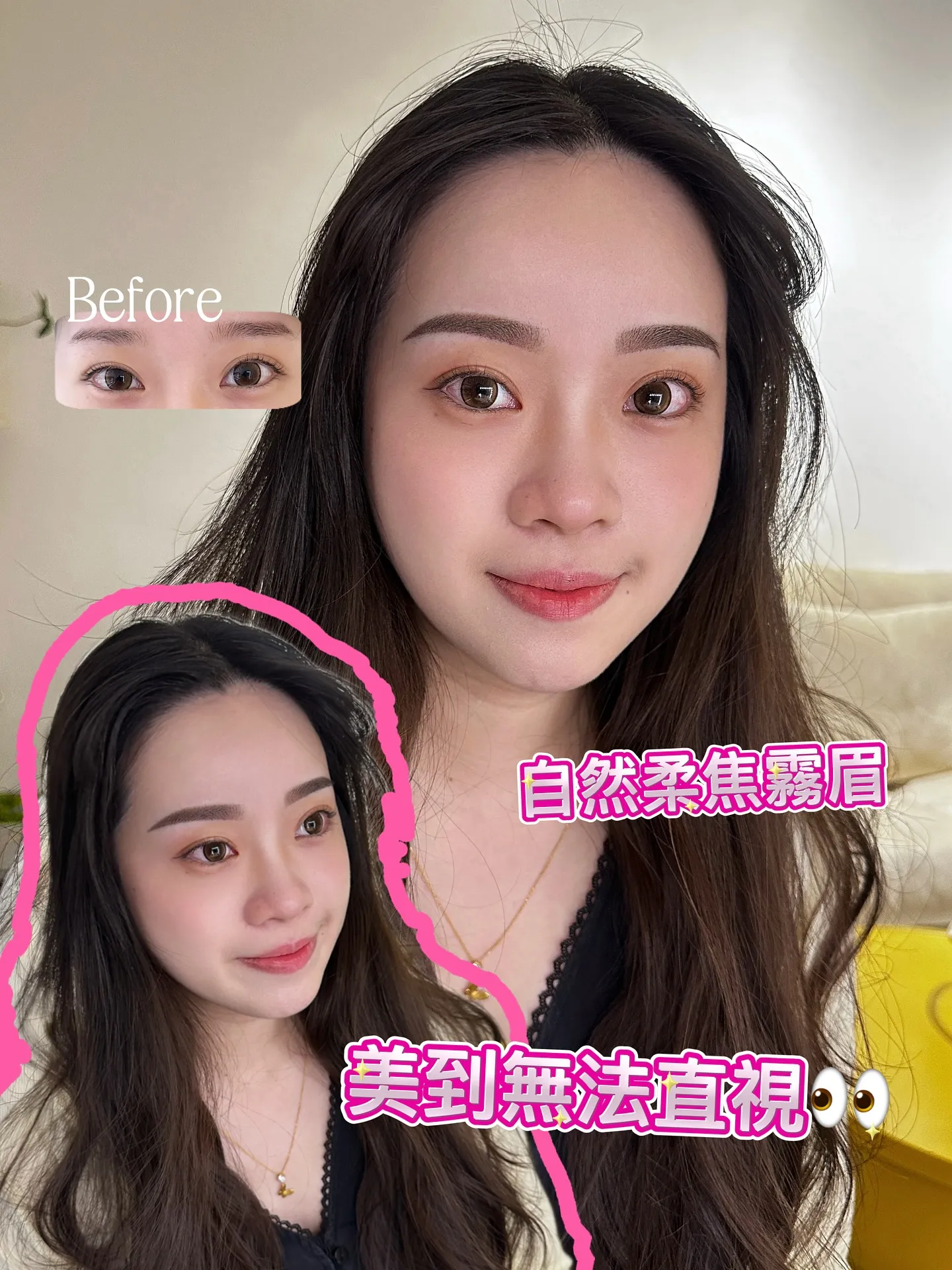 微整眉毛｜原來一對眉毛就能改變整體氣質！