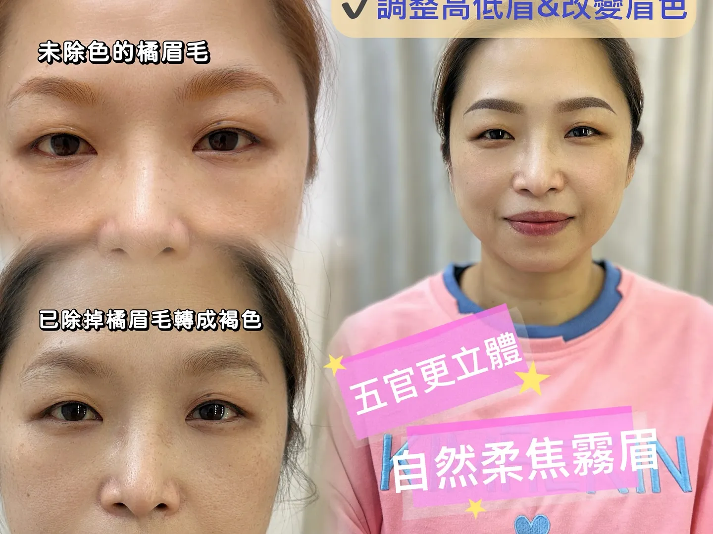 這樣的眉毛還救得回來嗎？