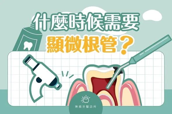 什麼時候需要顯微根管治療？