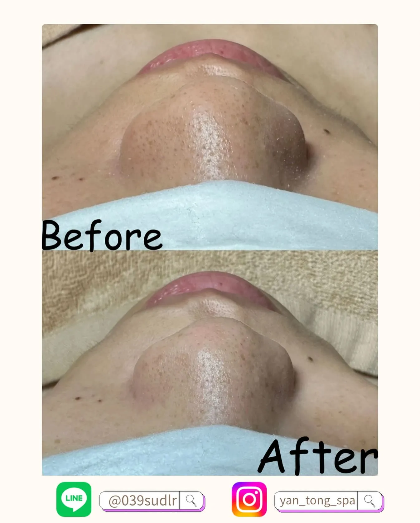 肌膚毛孔 定期保養 讓妳肌膚