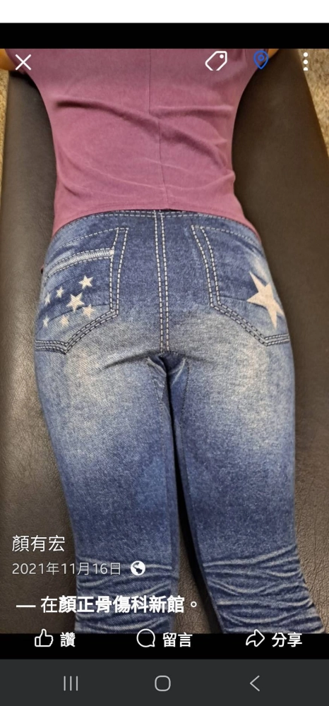 孕婦產後調整髖關節