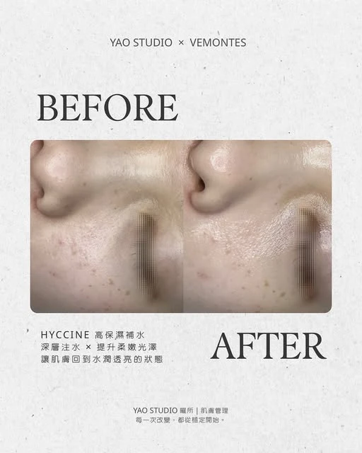 最近氣溫開始下降了， 許多人會覺得暗沉、粗糙、妝不貼， 以為只是「換季必然」或「膚質就是這樣」。