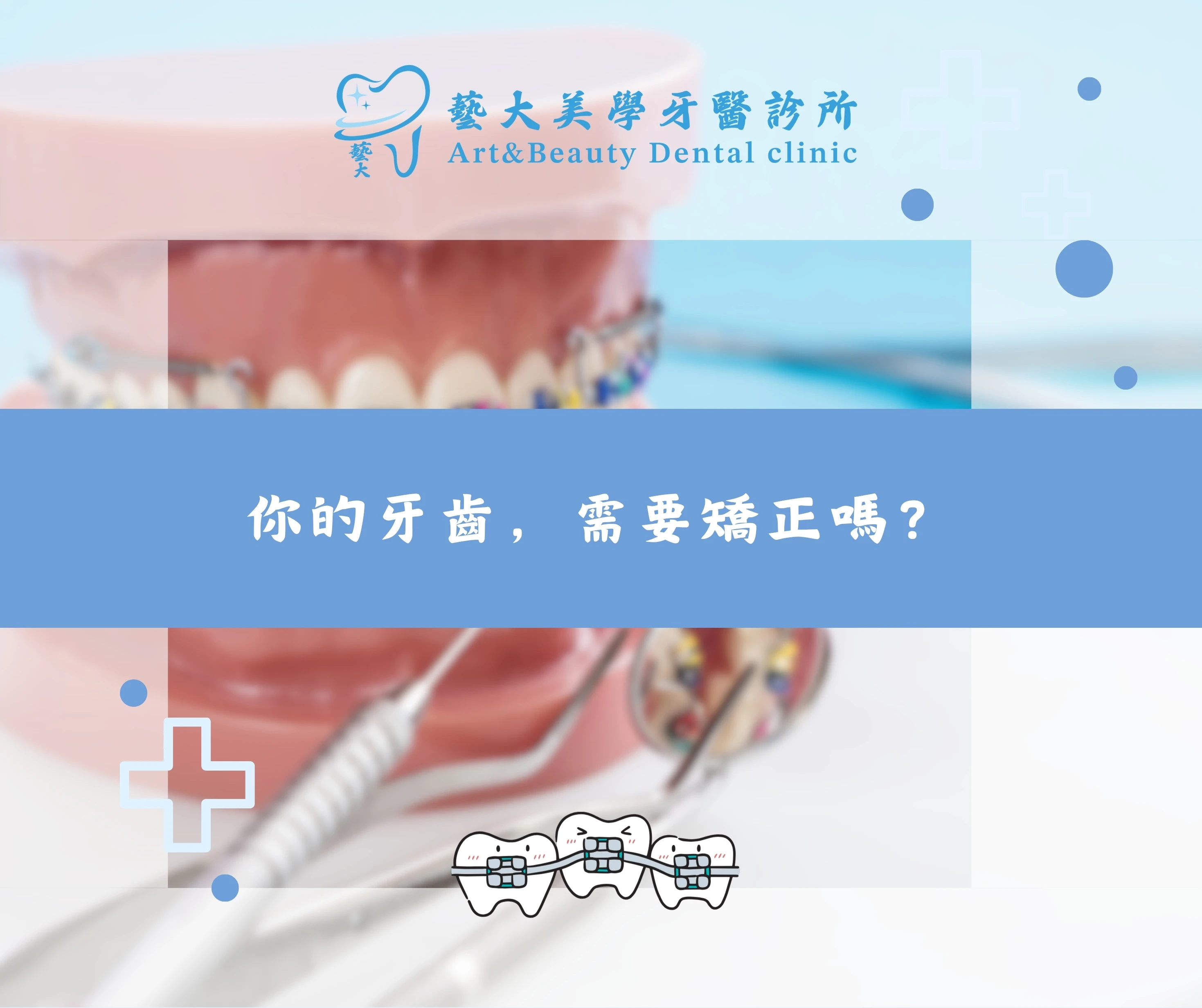 你的牙齒，需要矯正嗎？