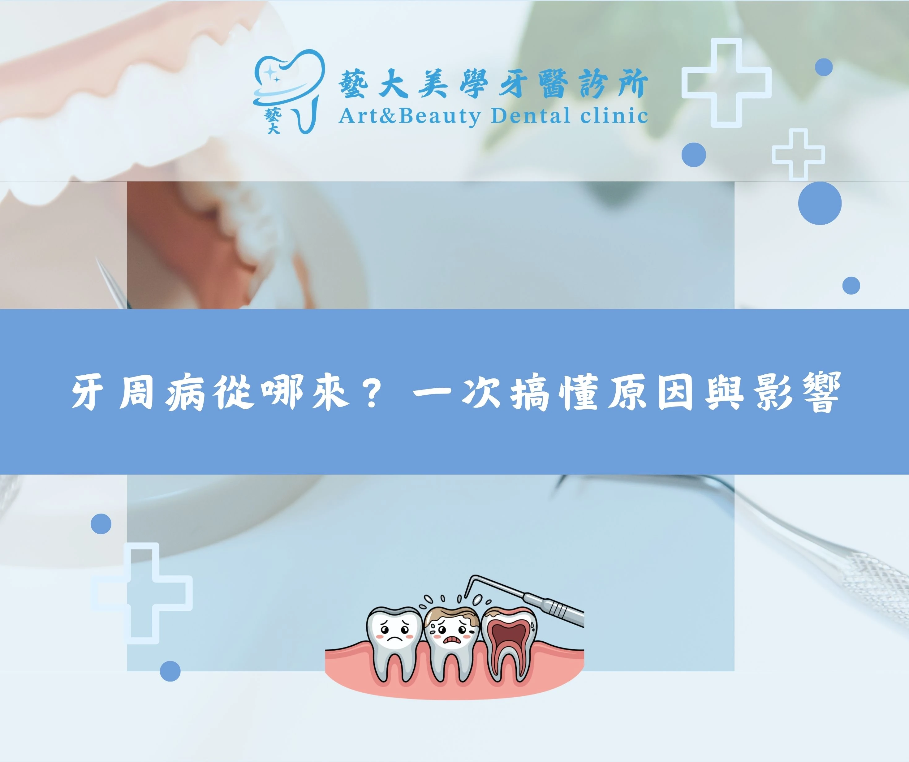 牙周病從哪來？一次搞懂原因與影像