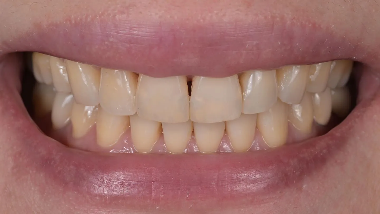 幸運的解鎖不同相機成就