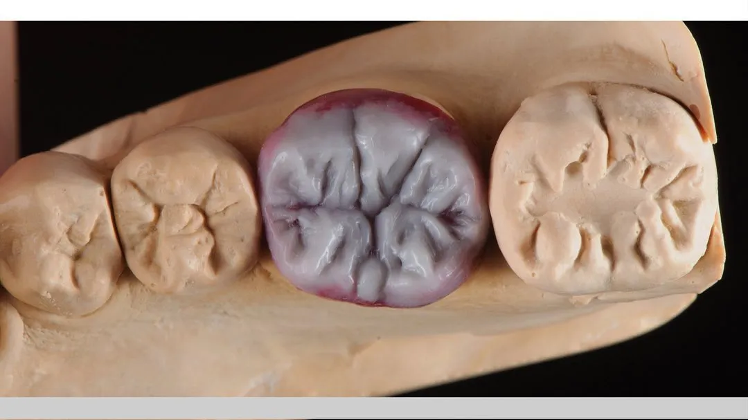 日常工作  46.Press