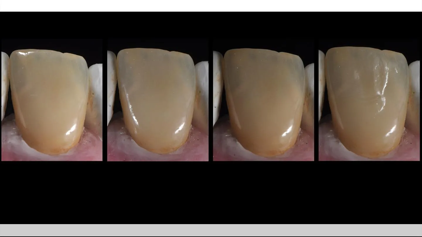 技師端的拍照紀錄