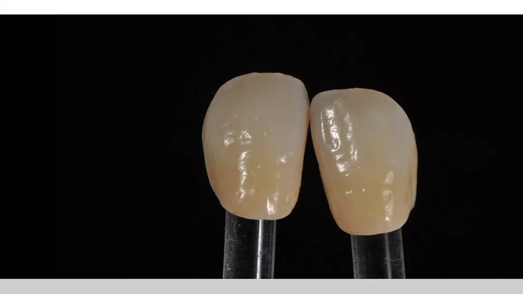 12.22 - Zirconia layering