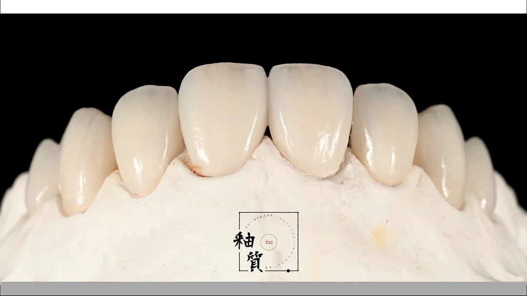 OM2 美白色 - 與我們一同打造自信笑容