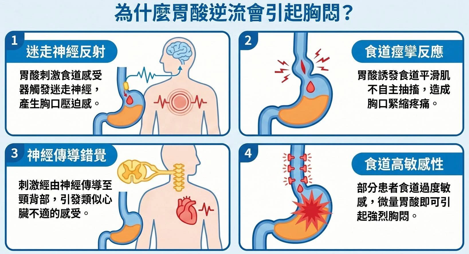 為什麼胃酸逆流會胸痛？