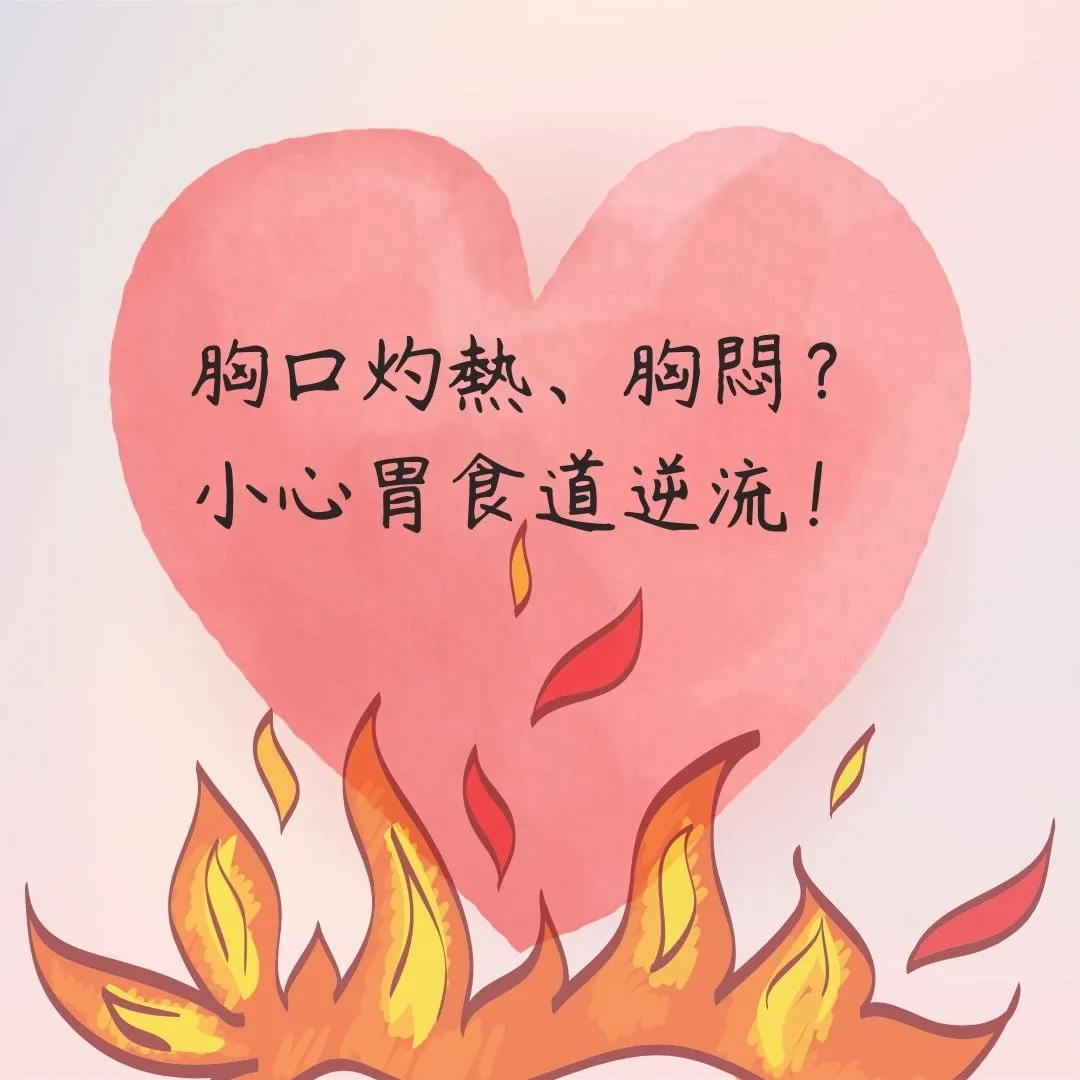 火燒心＝胃食道逆流