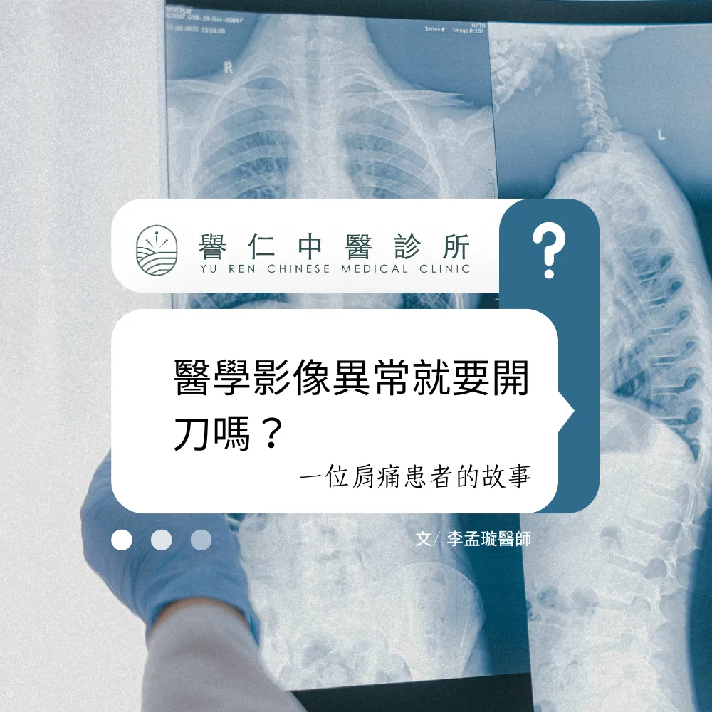 「醫學影像異常，就要開刀嗎?」— 一位肩痛病人的故事