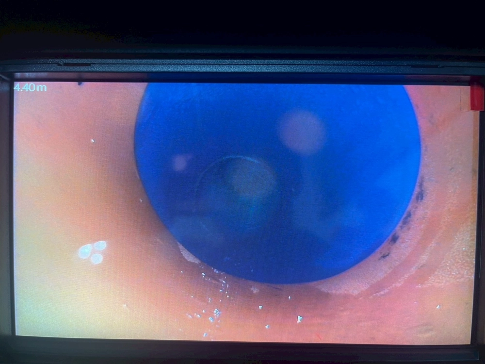 管路內視鏡檢測