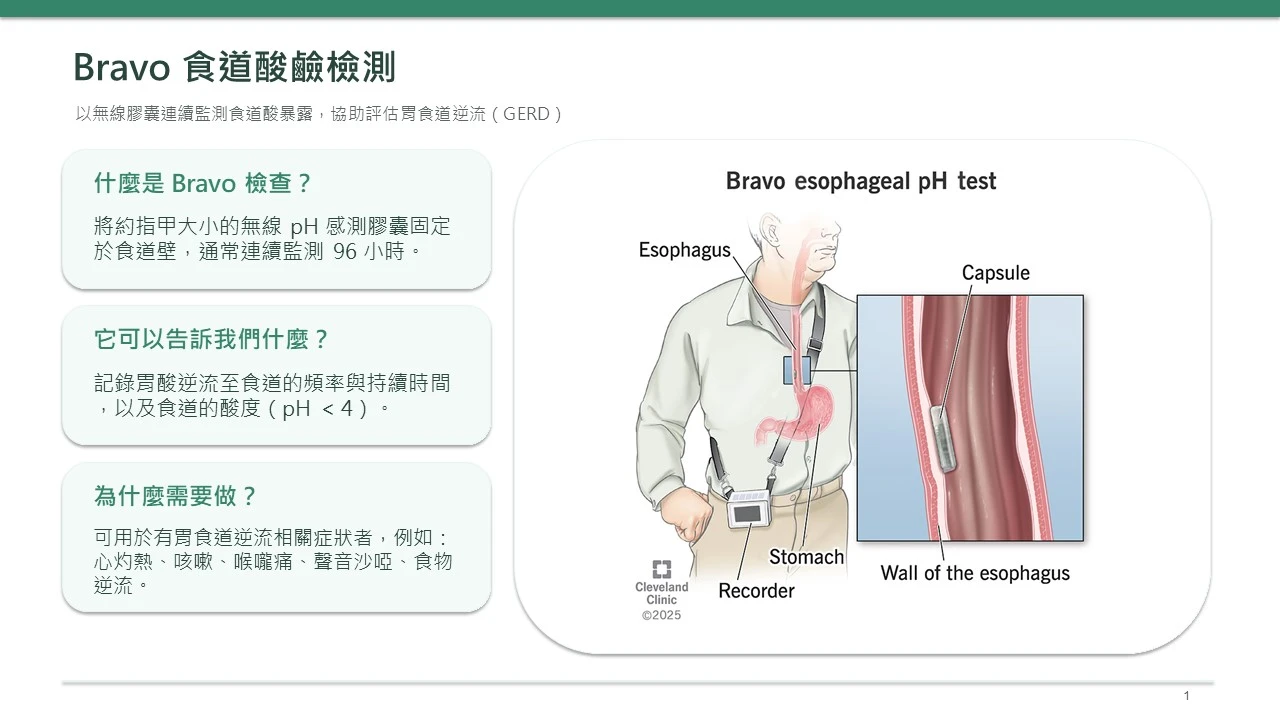 Bravo 食道酸鹼檢測