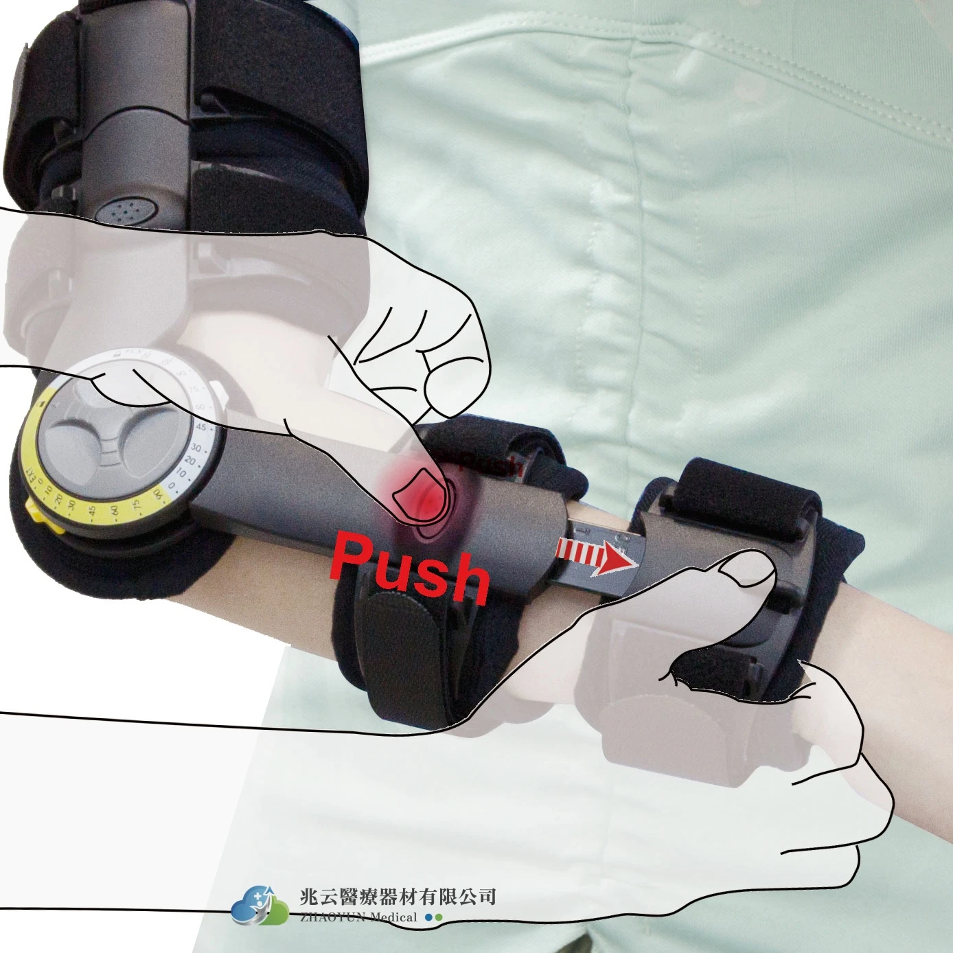 Conwell  可調長度肘關節護具 