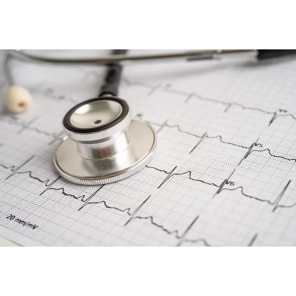 12 Lead EKG-心電圖